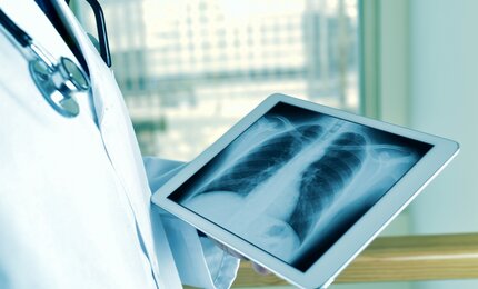 Arzt betrachtet ein Röntgenbild auf einem Tablet
