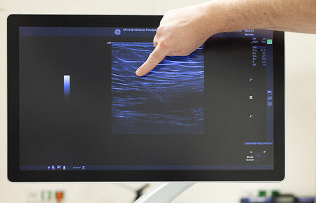 Finger zeigt auf einen Ausschnitt eines Ultraschallbilds