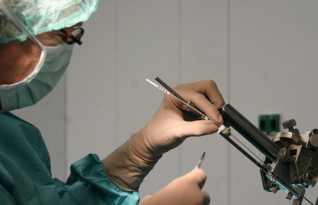 Stereotaktische Implantation der THS-Elektrode