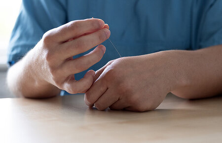 Weibliche Hand platziert eine Akupunktur-Nadel im Handrücken ihrer anderen Hand