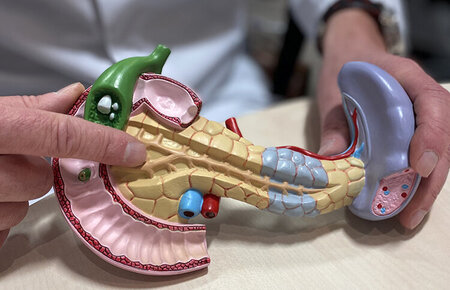 Arzt zeigt ein Pankreas-Modell 