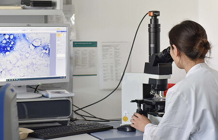 Ärztin am Mikroskop bei der zytomorphologische Diagnostik