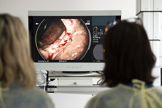 Zwei weibliche Personen blicken auf einen Monitor, auf dem Bilder einer Darmspiegelung zu sehen sind.