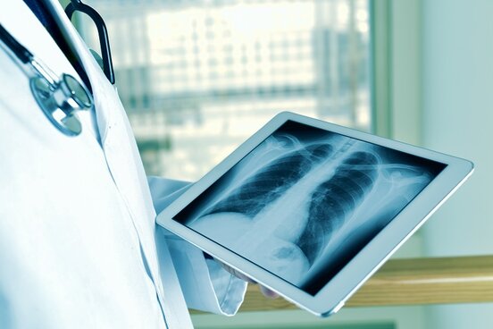 Ein Tablet wird vor dem Arztkittel gehalten, das Display zeigt ein Thorax-Röntgenbild.