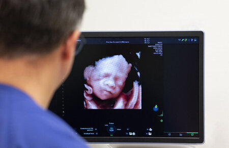 Arzt vor einem Ultraschallgerät, auf dessen Monitor das Gesicht eines Feten zu sehen ist.