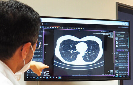 MUDr. Mahmoud Ismail erklärt was auf den CT-Aufnahmen der Lunge zu erkennen ist.
