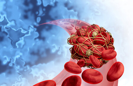 Illustration von verklumpten Blutzellen